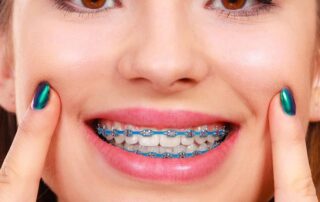 Orthodontic Braces Rubber Chains Power Chains Dental Rubber Chains for Braces Rubber Block Chain