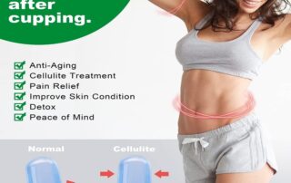 Silicone Cupping Therapy Facial Suction Cups Anti Cellulite Vacuum Suction Cellulite Remover Cup