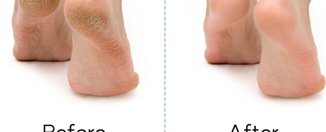 Feet Cleaner Washer Brush for Shower Floor Spas Massage Slipper for Exfoliating Cleaning Foot