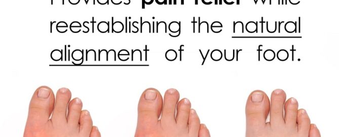 Silicone Step Toe Separators Natural Toe Spacers Separators Ease Relief Silicone Toe Correctors